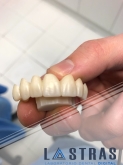 Laboratorio Dental Lastras en Valladolid