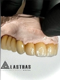 Laboratorio Dental Lastras en Valladolid