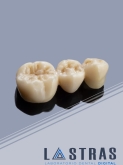 Laboratorio Dental Lastras en Valladolid