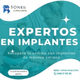 Sonríe Clínica Dental Valladolid - Implantes dentales, endodoncias y ortodoncia