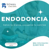 Sonríe Clínica Dental Valladolid - Implantes dentales, endodoncias y ortodoncia