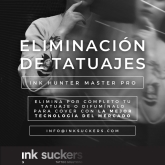 Eliminación de Tatuajes Valladolid - Ink Suckers