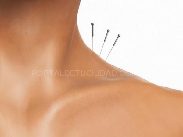 Bases científicas de la acupuntura