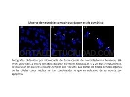 Muestran el proceso de activación de uno de los marcadores de Alzheimer