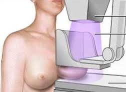 Casi 7.000 extremeñas se someterán a mamografías en octubre dentro del Programa de Detección Precoz del Cáncer de Mama