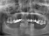 DENTISTA EN CORUÑA. DENTISTA BARATO EN CORUÑA. EL MEJOR DENTISTA DE CORUÑA. DENTISTA RONDA OUTEIRO