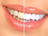 DENTISTA EN CORUÑA. DENTISTA BARATO EN CORUÑA. EL MEJOR DENTISTA DE CORUÑA. DENTISTA RONDA OUTEIRO